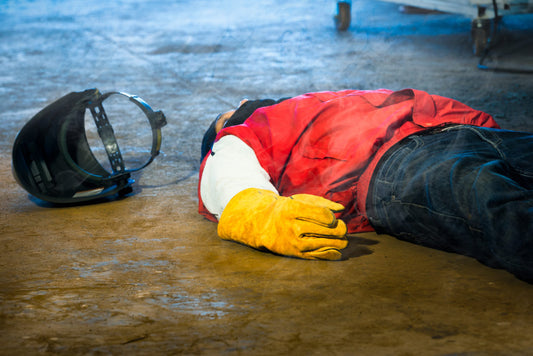 How To Treat Welding Burns And Preventive Measures Before Things Go South